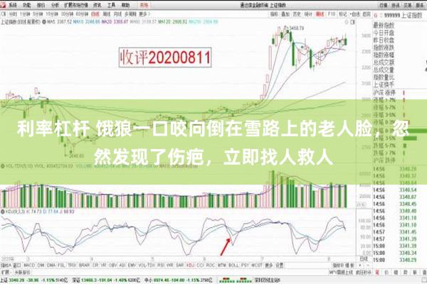 利率杠杆 饿狼一口咬向倒在雪路上的老人脸，忽然发现了伤疤，立即找人救人